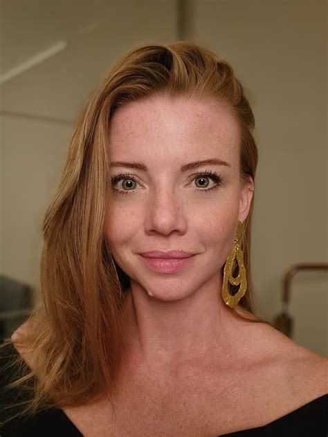 freckledplus OnlyFans Leaks 2025