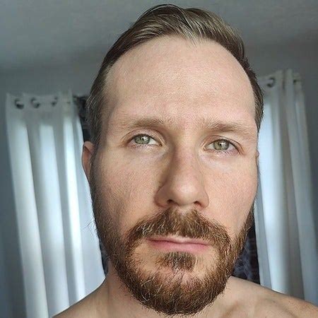 albinoadonis OnlyFans Leaks 2025